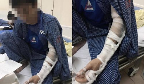 Hà Nội: Đánh người nhập viện vì tranh giành chỗ dán quảng cáo thông bể phốt - Ảnh 1