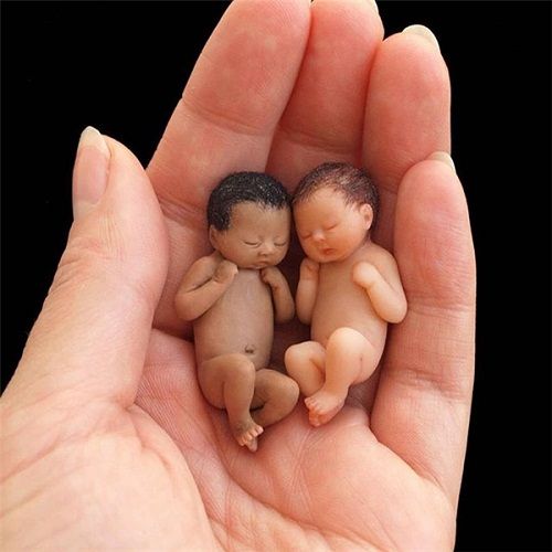 Ngỡ ngàng trước hình ảnh những em bé sơ sinh nhỏ hơn cả bàn tay siêu đáng yêu - Ảnh 9