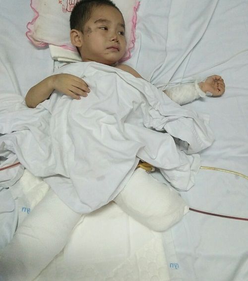 Cậu bé mất 2 chân sau vụ sạt lở đất ở Sơn La: "Mẹ ơi cứu con" - Ảnh 1