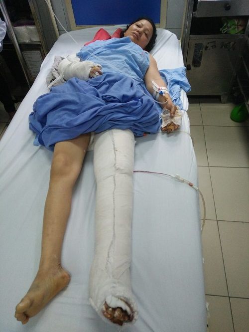 Cậu bé mất 2 chân sau vụ sạt lở đất ở Sơn La: "Mẹ ơi cứu con" - Ảnh 2