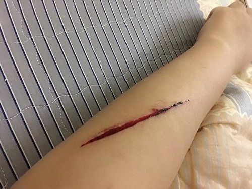 Hà Nội: Cô gái trẻ tự rạch tay, tung tin đồn bị cướp túi xách trên đường Láng - Ảnh 2