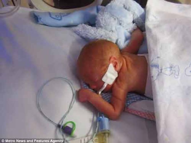 Rúng động y tá tự ý rút ống thở khiến bé sinh non tử vong - Ảnh 1