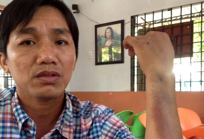 Con trai Giám đốc CA tỉnh Cà Mau: "Tôi bị đánh hội đồng" - Ảnh 1