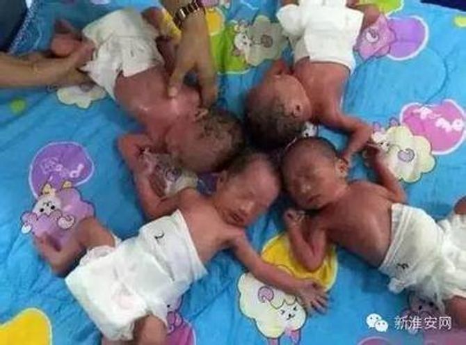 Bất ngờ sinh 4 "công chúa" dù bác sĩ bảo chỉ mang thai 3 - Ảnh 1