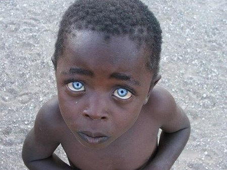 Những người có đôi mắt “kỳ dị” nhất thế giới