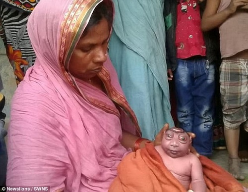 Newborn with Rare Syndrome Abandoned by Mother After Being Called 'Alien'