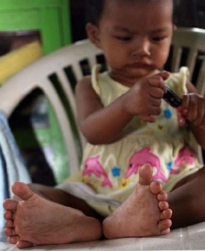 Cộng đồng mạng - Em bé sở hữu 26 ngón tay, chân, gia đình mừng rỡ vì lý do đặc biệt (Hình 2).