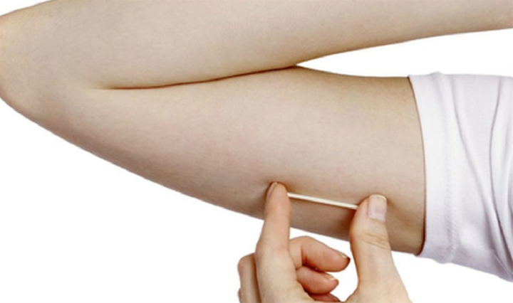 Sức khoẻ - Làm đẹp - Tin tức đời sống ngày 30/9: Que tránh thai đi lạc vào sâu trong cơ bắp tay người phụ nữ