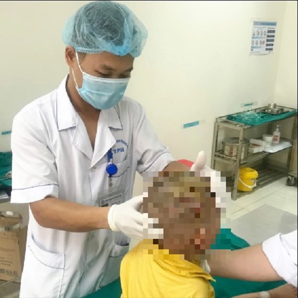 Sức khoẻ - Làm đẹp - Bé trai ở Thanh Hóa bị chó cắn tổn thương nặng tại vùng đầu, mặt
