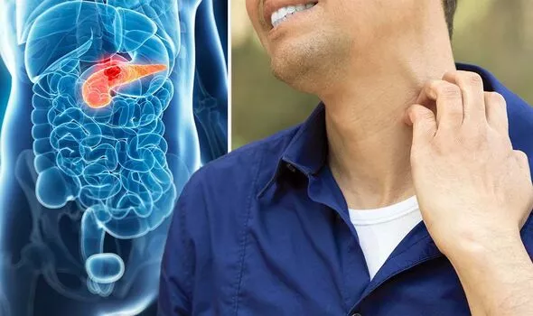 Sức khoẻ - Làm đẹp - Người đàn ông phát hiện mắc ung thư tuyến tụy sau khi bị ngứa khắp cơ thể