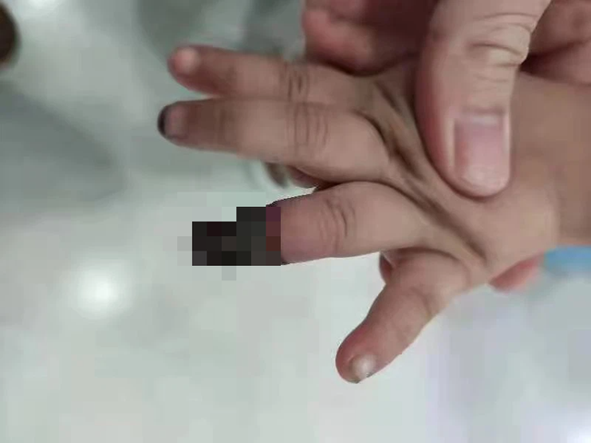 Gia đình - Tình yêu - Cháu gái 3 tuổi bị đứt tay, bà dùng cách này cầm máu khiến bác sĩ buộc phải cắt cụt ngón đứa trẻ