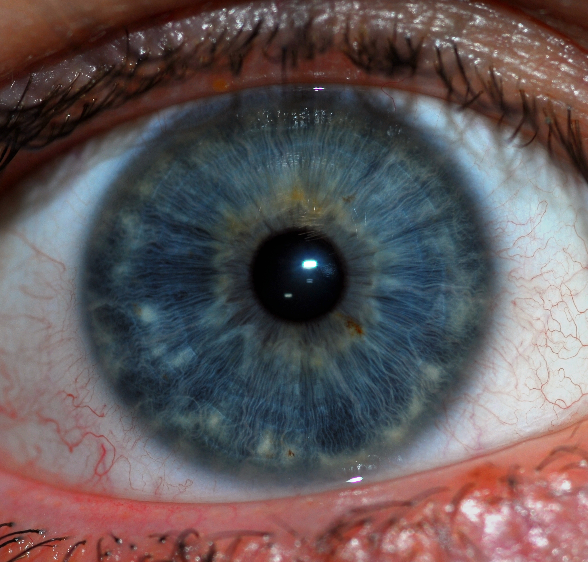 Sức khoẻ - Làm đẹp - Bác sĩ phân tích ưu nhược điểm khi sử dụng mống mắt được thu thập làm dữ liệu thẻ căn cước
