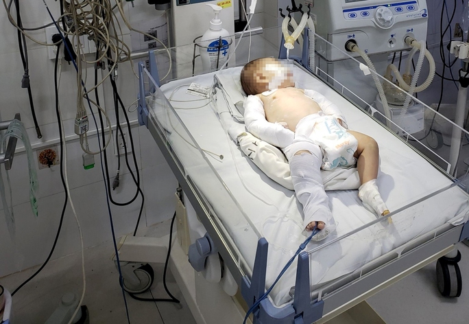 Pháp luật - Điều tra vụ bé 3 tháng tuổi cấp cứu trong tình trạng đa chấn thương, nghi bị bạo hành