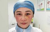 Tin thế giới - Ngã gãy sống mũi vì làm việc kiệt sức, nữ y tá Vũ Hán vẫn quyết tâm ở lại tuyến đầu tiếp tục chống dịch