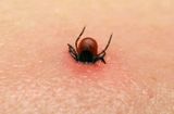 Tin thế giới - Trung Quốc tái bùng phát virus Bunya do bọ ve cắn khiến 9 người chết