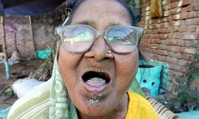 Lạ kỳ cụ bà 92 tuổi ăn 1kg cát mỗi ngày