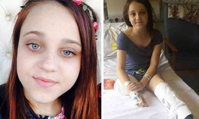 Bé gái 13 tuổi muốn cắt chân vì có quá nhiều khối u