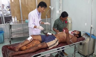 Hiện trường - Đắk Nông: 4 thanh niên bị thương do cắt cỏ trúng đầu đạn