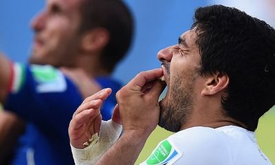 Suarez không cắn người, lỗi ở… hàm răng vẩu?