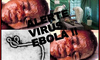 Đại dịch Ebola bùng phát là do nghèo khổ, y đức