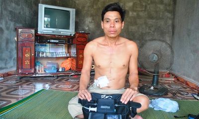 Người duy nhất ở Việt Nam sống nhờ sạc điện vào tim
