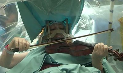 Bệnh nhân chơi violin trong ca phẫu thuật não