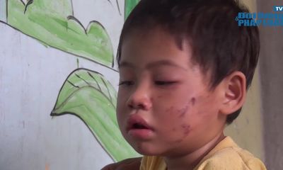 Bé gái 2 tuổi bị bạo hành dã man 
