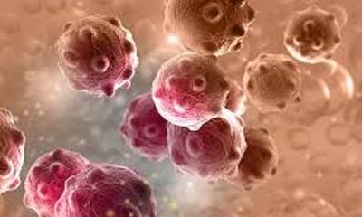Phát hiện hợp chất mới có thể tiêu diệt tế bào ung thư mà không gây phản ứng phụ