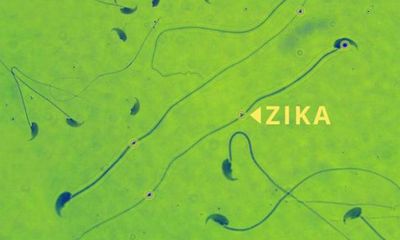 Vi rút Zika có thể gây teo tinh hoàn?