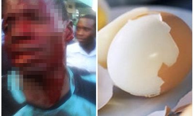 Người đàn ông bị đánh tơi tả vì gạ tình bằng… quả trứng