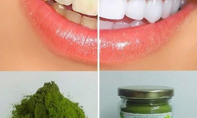 3 cách làm trắng răng bằng trà xanh đơn giản tại nhà