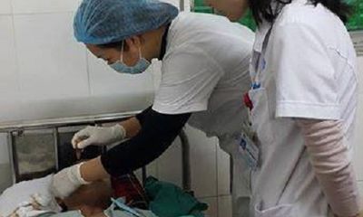 Bệnh viện E cấp cứu thành công bệnh nhân bị súng hoa cải bắn vào mặt