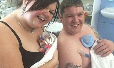 Cuộc đấu tranh vất vả giành lại sự sống của cặp song sinh sớm 3 tháng