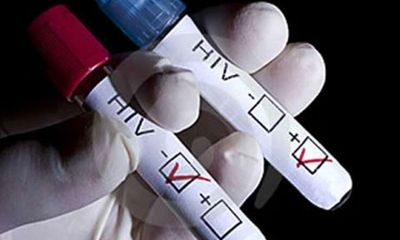 Sáng chế mới giúp phát hiện HIV chỉ sau 1 tuần phơi nhiễm