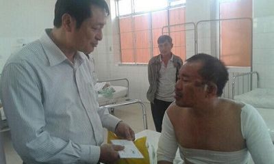 Tin mới về sức khỏe nạn nhân vụ nổ tại nhà máy Nhiệt điện Vĩnh Tân 4