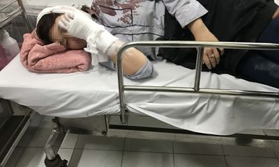 Lời kể của nữ sinh bị đánh vào đầu phải nhập viện Bạch Mai cấp cứu