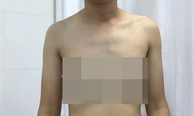 Việt Nam: Chuẩn bị phẫu thuật chuyển giới cho trường hợp đầu tiên