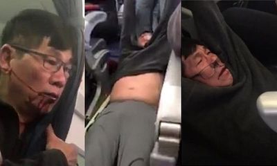 Dư luận chỉ trích cảnh sát sau vụ bác sĩ bị kéo lê trên máy bay United Airlines