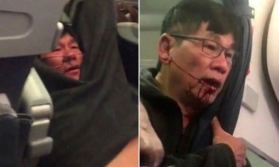 David Dao không được hãng United Airlines trả hành lý sau khi bị kéo lê ra khỏi máy bay