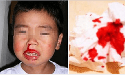 Con trai 2 tuổi qua đời vì chảy máu cam, mẹ hối hận phát điên khi biết nguyên nhân