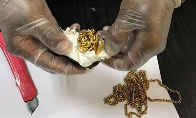 Người đàn ông Sri Lanka nhét gần 1kg vàng vào trực tràng