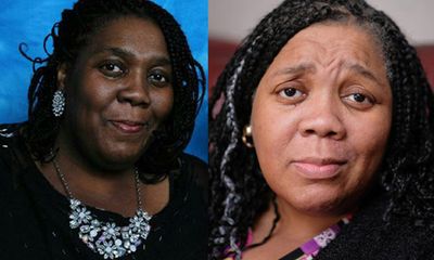 Kỳ lạ người phụ nữ da đen biến thành trắng sau uống thuốc chữa ung thư