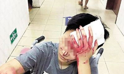 Trung Quốc: Bị đánh vỡ đầu vì phàn nàn khi bị giao đồ ăn chậm