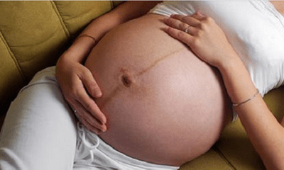 Tiết lộ thú vị về đường sọc nâu giữa bụng mẹ bầu mà nhiều người chưa biết