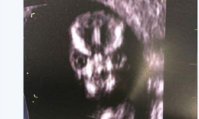 Khoe bức ảnh siêu âm thai nhi kỳ lạ, người mẹ khiến nhiều người ngạc nhiên