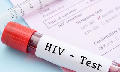 Thực hư thông tin người nhiễm HIV có thể sống lâu như người thường?