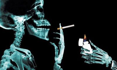 Tác hại của thuốc lá với bệnh đau dạ dầy