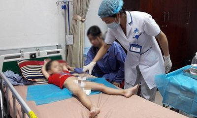 Điều trị miễn phí trẻ mắc sùi mào gà ở Hưng Yên đến hết năm 2018