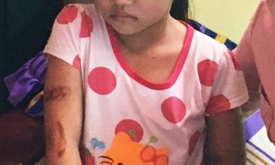 Bé gái 7 tuổi nghi bị cha ruột, mẹ kế bạo hành có dấu hiệu hoảng loạn