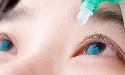 Phát hiện thuốc nhỏ mắt mới có thể khiến người mắc tật khúc xạ không phải đeo kính